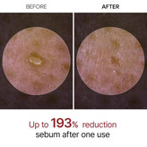پیلینگ شات برنج سیاه دکتر ملاکسین Dr.Melaxin Peel Shot Glow Black Rice Peeling