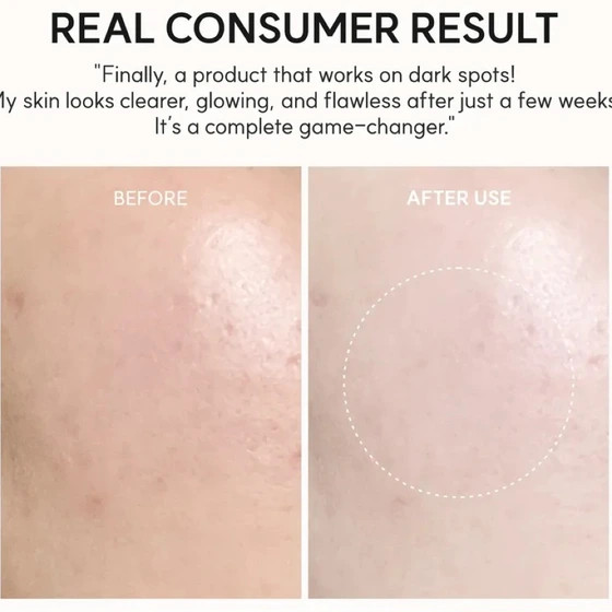 ژل کرم روشنکننده و درخشانکننده ویتامین C آرنسیا ۵۰ گرم Arencia Vitamin C Glow Booster Gel Cream 50 g