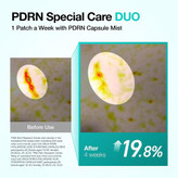 پچ کلاژن ذوبشونده PDRN آنوا برای گردن