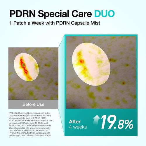 پچ کلاژن ذوبشونده PDRN آنوا برای گردن