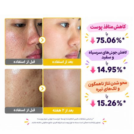 سرم پیل شات کوجیک اسید و زردچوبه مدی کیوب